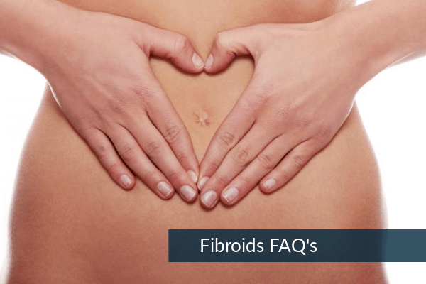 Fibroids FAQ’s Fibroids-FAQs-1-1