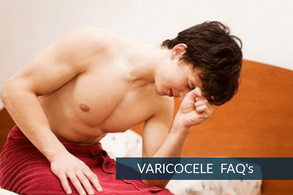 Varicocele FAQ’s VARICOCELE-FAQs-