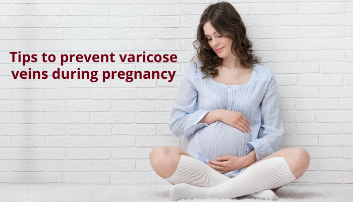 Tips to Prevent Varicose Veins During Pregnancy